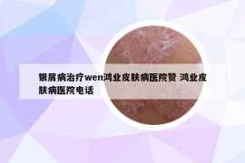 银屑病治疗wen鸿业皮肤病医院赞 鸿业皮肤病医院电话