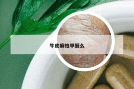 牛皮癣怕甲醛么