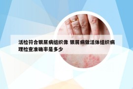 活检符合银屑病组织像 银屑病做活体组织病理检查准确率是多少