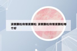 消银颗粒和银屑颗粒 消银颗粒和银屑颗粒哪个好