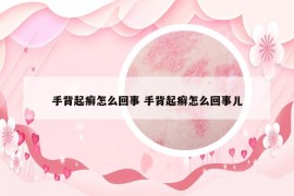 手背起癣怎么回事 手背起癣怎么回事儿