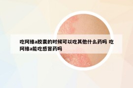 吃阿维a胶囊的时候可以吃其他什么药吗 吃阿维a能吃感冒药吗