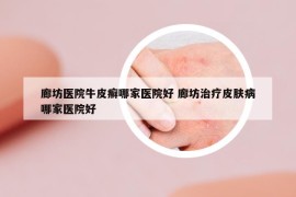 廊坊医院牛皮癣哪家医院好 廊坊治疗皮肤病哪家医院好