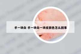 手一块白 手一块白一块皮肤色怎么回事