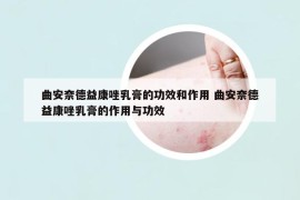 曲安奈德益康唑乳膏的功效和作用 曲安奈德益康唑乳膏的作用与功效