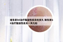 维生素b6治疗脂溢性皮炎吃多久 维生素b6治疗脂溢性皮炎一天几粒