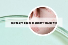 银屑病关节炎秘方 银屑病关节炎秘方大全