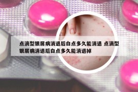 点滴型银屑病消退后白点多久能消退 点滴型银屑病消退后白点多久能消退掉