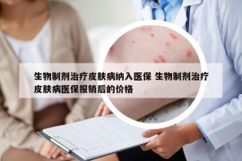 生物制剂治疗皮肤病纳入医保 生物制剂治疗皮肤病医保报销后的价格