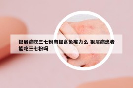 银屑病吃三七粉有提高免疫力么 银屑病患者能吃三七粉吗