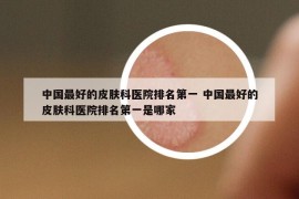中国最好的皮肤科医院排名第一 中国最好的皮肤科医院排名第一是哪家