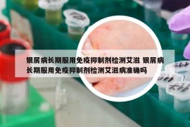 银屑病长期服用免疫抑制剂检测艾滋 银屑病长期服用免疫抑制剂检测艾滋病准确吗