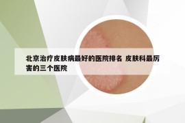 北京治疗皮肤病最好的医院排名 皮肤科最厉害的三个医院