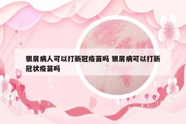 银屑病人可以打新冠疫苗吗 银屑病可以打新冠状疫苗吗