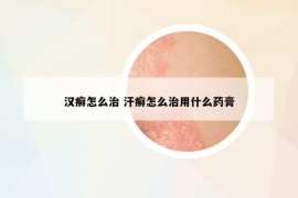 汉癣怎么治 汗癣怎么治用什么药膏