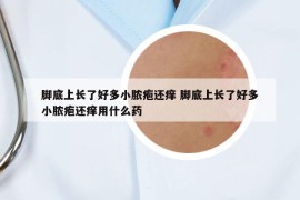 脚底上长了好多小脓疱还痒 脚底上长了好多小脓疱还痒用什么药