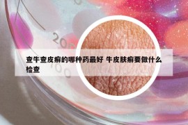 查牛查皮癣的哪种药最好 牛皮肤癣要做什么检查