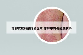 邯郸皮肤科最好的医院 邯郸市有名的皮肤科