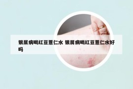 银屑病喝红豆薏仁水 银屑病喝红豆薏仁水好吗