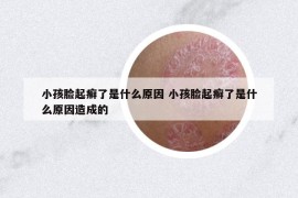 小孩脸起癣了是什么原因 小孩脸起癣了是什么原因造成的