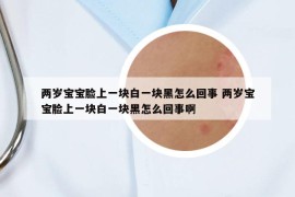 两岁宝宝脸上一块白一块黑怎么回事 两岁宝宝脸上一块白一块黑怎么回事啊