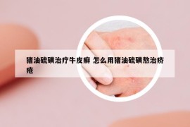 猪油硫磺治疗牛皮癣 怎么用猪油硫磺熬治疥疮