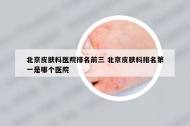 北京皮肤科医院排名前三 北京皮肤科排名第一是哪个医院
