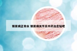 银屑病正骨水 银屑病关节炎中药治愈贴吧