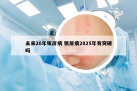 未来20年银屑病 银屑病2025年有突破吗