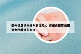 郑州银屑病来瞧刘长江放心 郑州市银屑病研究会所看病怎么样