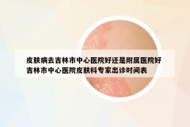 皮肤病去吉林市中心医院好还是附属医院好 吉林市中心医院皮肤科专家出诊时间表