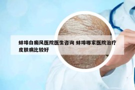 蚌埠白癜风医院医生咨询 蚌埠哪家医院治疗皮肤病比较好