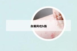 白癜风吃b族