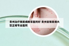 贵州治疗银屑病那家医院好 贵州省银屑病大型正规专业医院