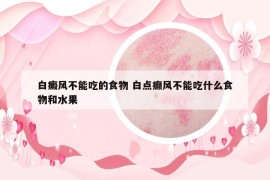 白癜风不能吃的食物 白点癫风不能吃什么食物和水果