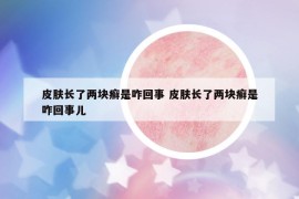 皮肤长了两块癣是咋回事 皮肤长了两块癣是咋回事儿