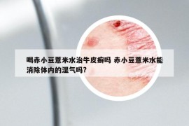 喝赤小豆薏米水治牛皮癣吗 赤小豆薏米水能消除体内的湿气吗?