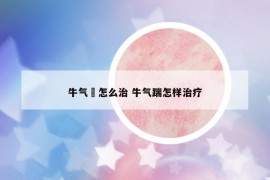 牛气廯怎么治 牛气踹怎样治疗