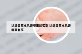 达康臣草本乳膏哪里能买到 达康臣草本乳膏哪里有买