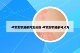 寻常型银屑病同型反应 寻常型银屑病可分为