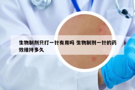 生物制剂只打一针有用吗 生物制剂一针的药效维持多久