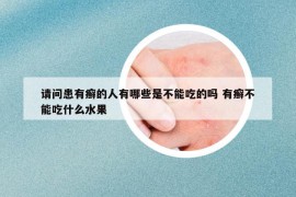 请问患有癣的人有哪些是不能吃的吗 有癣不能吃什么水果