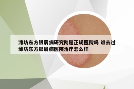 潍坊东方银屑病研究院是正规医院吗 谁去过潍坊东方银屑病医院治疗怎么样