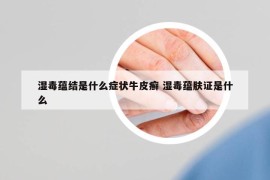 湿毒蕴结是什么症状牛皮癣 湿毒蕴肤证是什么