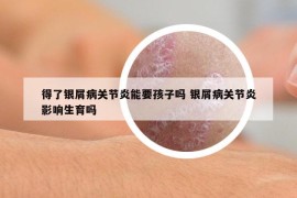 得了银屑病关节炎能要孩子吗 银屑病关节炎影响生育吗