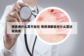 银屑病什么菜不能吃 银屑病都能吃什么菜还有肉类