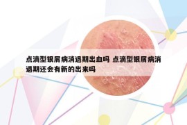 点滴型银屑病消退期出血吗 点滴型银屑病消退期还会有新的出来吗