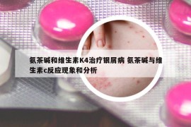 氨茶碱和维生素K4治疗银屑病 氨茶碱与维生素c反应现象和分析