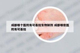 成都哪个医院有可善挺生物制剂 成都哪些医院有可善挺