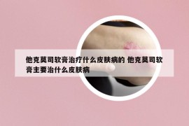 他克莫司软膏治疗什么皮肤病的 他克莫司软膏主要治什么皮肤病